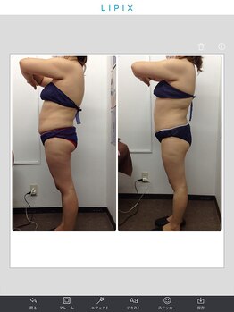 健康痩身研究所 蟹江店/ビフォーアフター