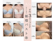 ウルエッテ(UluEtte)