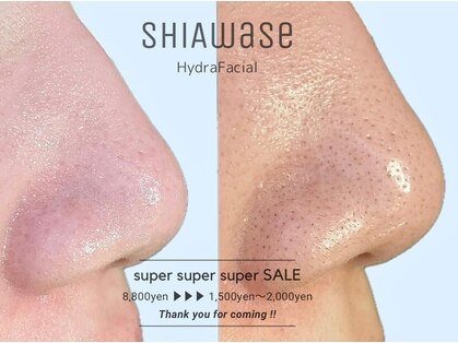 シアワセ(shiAwase)の写真