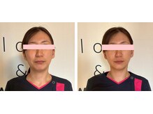 ヨサパーク リアン(YOSA PARK Lien)/モニター様before→after/痩身