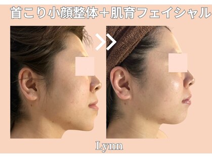 リン(Lynn)の写真