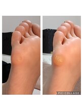 遊歩堂/小指下タコ