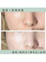 ソワ 吉塚店(soi)/驚異のトーンアップ！