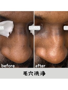 ルアナ 北谷店/ハーブピーリング 《沖縄/北谷》