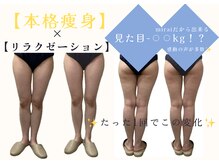 ミライ 福岡筑紫野店(mirai)/本格痩身