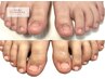 【FOOT長さだし深爪矯正】即綺麗になれるアート付き　17300円