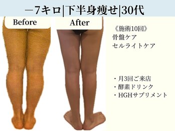 京都フォーエイチ(京都4H)/セルケア×下半身温活ケア