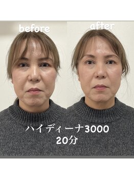 ヨサパーク ハナ 六甲道(YOSA PARK HANA)/