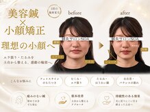 ノア(NOA)