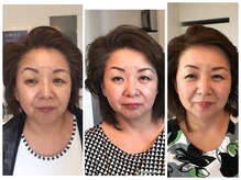 エステティックサロン エスぺランス(ESPERANCE)/Ravissaでこんなに肌が変わる！