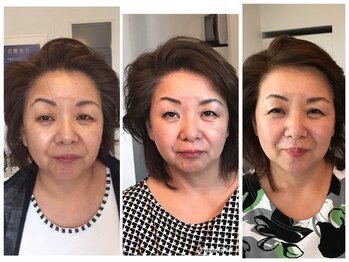 エステティックサロン エスぺランス(ESPERANCE)/Ravissaでこんなに肌が変わる！