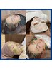 【肌質改善×お顔の引き上げ】電気美容鍼×ハーブピーリング（初回体験）