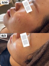 サロン サルー(SALON Salud)/◇再生美容