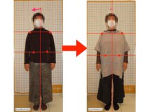 リファイン(Refine)/左股関節の痛み・歩行時痛