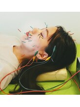 はり灸心音/美容鍼比較-スペシャル☆☆☆