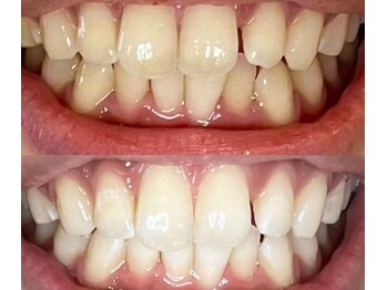 スリーエー(AAA)/笑顔美人になりませんか？