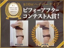 プライベートエステサロン リム(Lim)