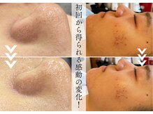 プロテュウス(PUROTUCE)の雰囲気（速効性があるから続けたくなる！この感動を是非ご体感ください♪）