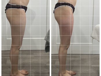 トータルビューティ リライフ(Total beauty Relife)/ウルトランス下半身