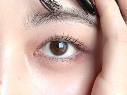シエナ アイ(CIENA eye)の写真