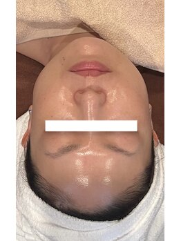 パーフェクトボディ(PERFECT BODY)/透き通るお肌へ導く美白ケア