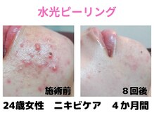 ラディアント たまプラーザ