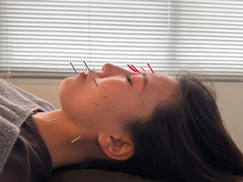 ハリサロンドオフ 心斎橋店(hari salon de off)の写真/【秋本番】乾燥と寒暖差でゆらぎやすい季節、早めのケアが美肌のカギ★美肌・リフトアップ効果も抜群◎