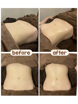 アネクル(ANECUL)/