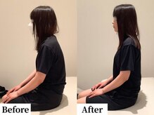 ソレア(Solea)/肩こり・猫背・巻き肩改善1回目