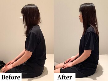 ソレア(Solea)/肩こり・猫背・巻き肩改善1回目