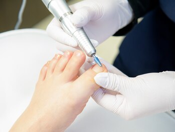 巻き爪補正店 千葉店の写真/巻き爪のスペシャリストによる施術で長年の爪の悩みを改善！【カウンセリング込☆巻き爪補正1ヵ所¥5500】