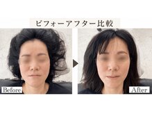 リラボ整体院 赤坂店(RE+LAB=◯整体院)/ビフォーアフター歪み