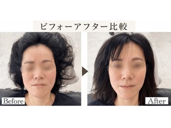 リラボ整体院 赤坂店(RE+LAB=◯整体院)/ビフォーアフター歪み