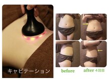 シェービング アンド エステ ローズマリー(Rosemary)の雰囲気（ハミ肉撃退◎スッキリボディ）