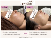 ユキエル(yukielle)の雰囲気(ベテランスタッフの経験と確かな技術でトータルビューティが叶う)