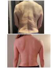 エムグレイス(m-grace's)/幹細胞インディバボディ　４回