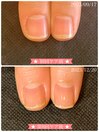 美爪育成ネイルケア3ヶ月コース