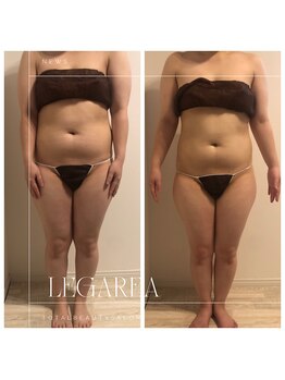 レガリア(LEGAREA)/