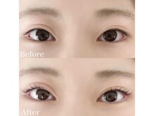 レピア 高槻店/韓国式LEPIA Before&After