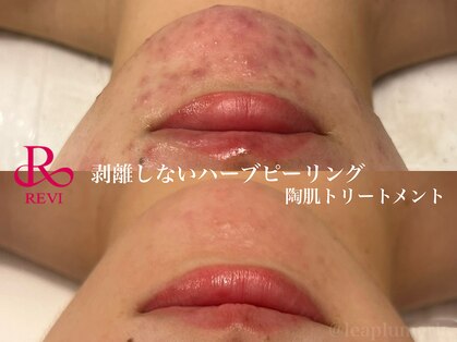 レアプルメリア(Lea Plumeria)の写真