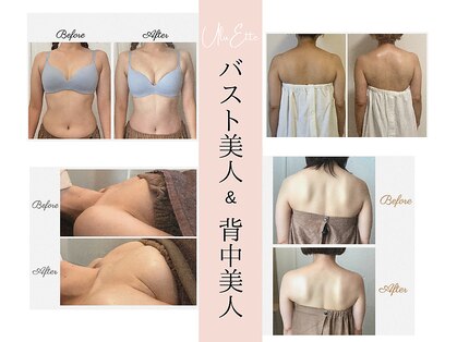 ウルエッテ(UluEtte)の写真