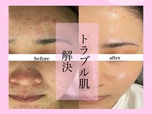 クウラ 学園前店(KUULa)