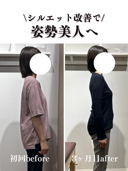 はぴねす鍼灸整骨院 アトレ大森院/【大森】施術変化初回