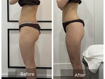 トータルビューティ リライフ(Total beauty Relife)/ウルトランス下半身