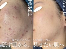 エル(Elle)