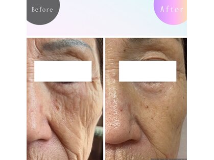 韓国肌管理・美肌脱毛【Rejouir】の写真