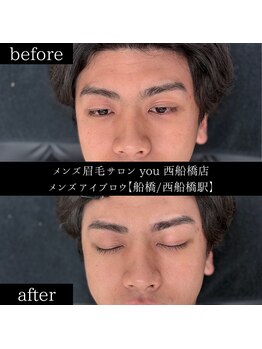 ユー 西船橋店(you)/ビフォーアフターお写真