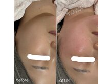 サロン エミリー(Salon Emily)/オンダリフト