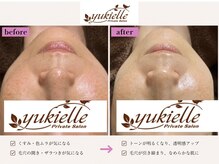 ユキエル(yukielle)の雰囲気(通うほどに効果を実感。お肌のお悩みを改善。なりたい肌になる!)