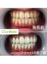 ルブラン 奈良店(Le Blanc)/ビフォーアフター！